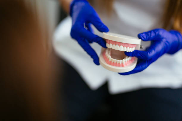 Best Teeth Whitening  in Linden, AL