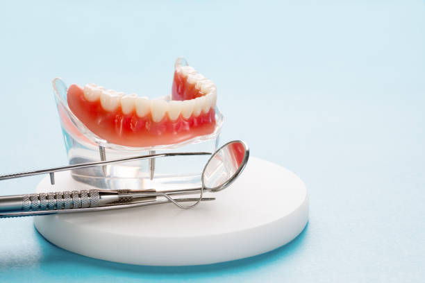 Best Wisdom Tooth Removal  in Linden, AL